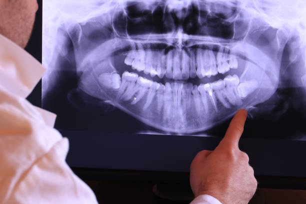 Best Urgent Care for Lost Fillings or Crowns in Walker, LA